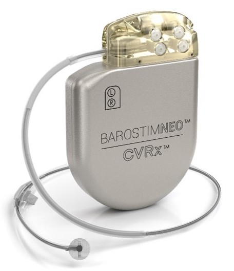 Barostim Baroflex Activation Therapy